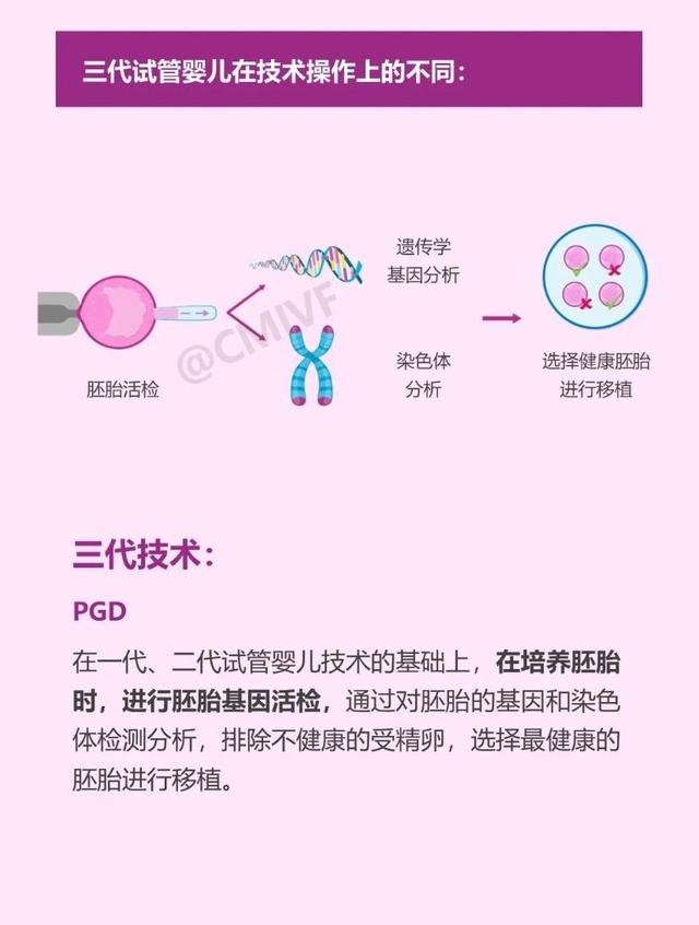 三代试管技术和一代二代有什么区别？