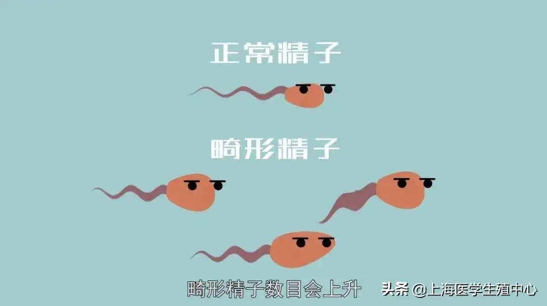 精子畸形是胎儿畸形的罪魁祸首吗？