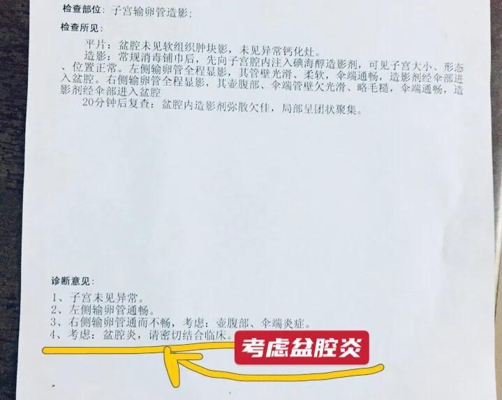 经久不治的盆腔炎，不仅能让育龄女士宫外孕，还严重影响身体健康