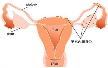 做试管婴儿的流程及基本要求