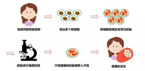 广州助孕三代试管婴儿流程时间(三代试管婴儿流程详解)