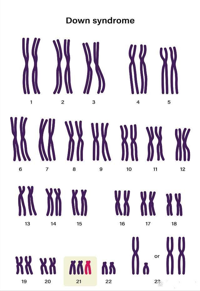 什么是染色体异常？染色体异常离我们并不遥远
