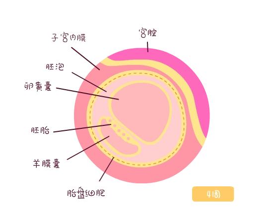 怀孕中期羊膜囊突出，该怎么保护胎儿？有哪些注意事项？