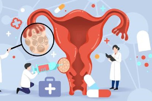 卵巢和子宫紧贴：卵巢和子宫紧贴会疼吗?