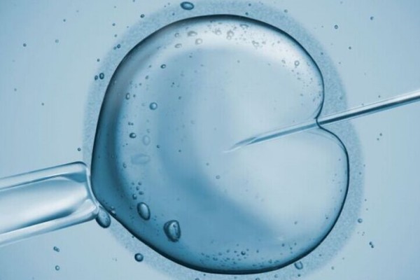 多囊卵巢做试管流程有哪些？会不会不一样？