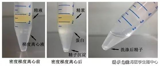 辅助生殖技术中精液是怎么优化的？