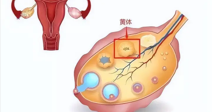 月经频繁竟是黄体功能不全？会导致不孕吗？