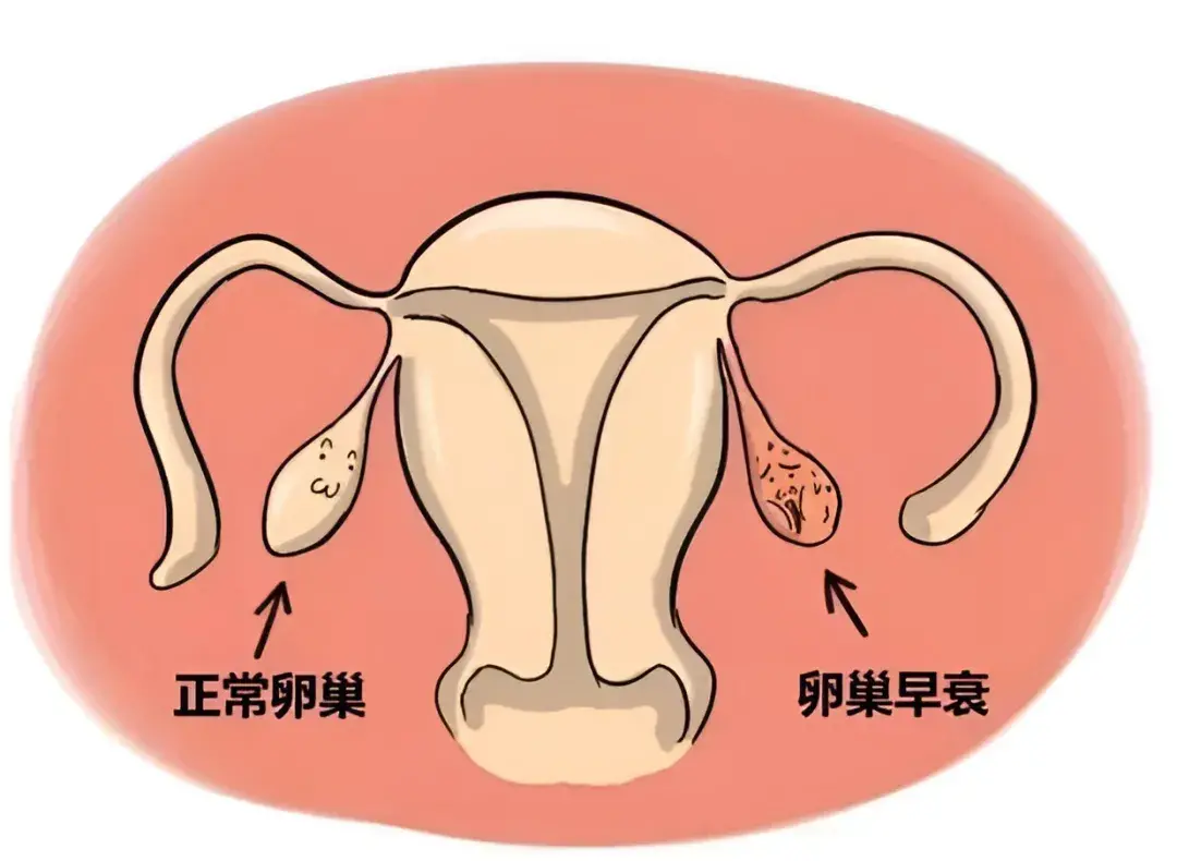 37岁，患有卵巢早衰能治好吗？