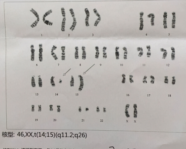 染色体+精子质量三大检查，男性孕前必查利器