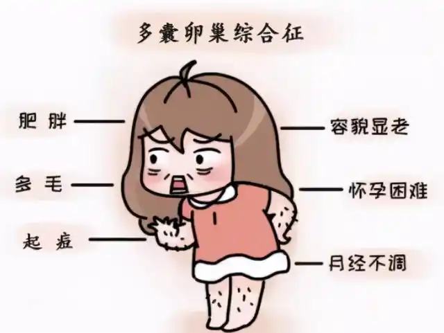 多囊要不要去做试管婴儿？